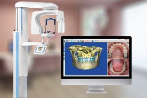 3D ακτινογραφία δοντιών στη Λάρισα | Drakotos-Antonios_CBCT_Promax_3D_imgaging, ΔΡΑΚΩΤΟΣ Γ. ΑΝΤΩΝΙΟΣ - Ακτινοδιαγνώστης – Στρατιωτικός Ιατρός ε.α Ακτινολόγος Λάρισα. ακτινολόγος λαρισα. Ακτινολογικό ιατρείο λάρισα. Aktinologo larisa. Ακτινογραφία Λάρισα. Drakotos-Antonios, aktinografia larisa, aktinologos larisa. Ακτινολόγος λάρισα, οικονομική ακτινογραφία, Ακτινολογικό Εργαστήριο στη Λάρισα, ακτινολογοι στη Λάρισα. Δρακωτός Γ. Αντώνιος. ΜΑΡΙΝΟΥ ΑΝΤΥΠΑ 2 κ ΚΟΥΜΑ, Κεντρική Πλατεία, Λάρισα. Τηλ.(2410) 258 000. Ακτινογραφία με απόλυτη ακρίβεια και μειωμένη έκθεση σε κίνδυνο. Planmeca ProMax 3D. Αξονική τομογραφία οδόντων κωνικής δέσμης CBCT. Έγχρωμα doppler υπερηχογραφήματα οσχέου. Έλεγχος fistula. Αξονική τομογραφία οδόντων κωνικής δέσμης CBCT. Ακτινογραφία ολόκληρης της άνω και κάτω γνάθου με μία μόνο λήψη. Ακτινογραφία Ultra Low Dose με ιδιαίτερα χαμηλή δόση ακτινοβολίας μειωμένη κατά 80% μικρότερη της τυπικής πανοραμικής. Ενδοοδοντολογία με ιδιαίτερα υψηλή ανάλυσηγια. Προσομοίωση τοποθέτησης εμφυτεύματος. Aktinografia larisa, Drakotos-Antonios, Δρακωτός Γ. Αντώνιος. Aktinologos larisa, aktinologos larissa, ακτινολόγος λάρισα, ακτινολόγος λάρισσα, οικονομική ακτινογραφία. Ακτινολογικό Εργαστήριο στη Λάρισα, ακτινολόγοι στη Λάρισα. Γιατροί ακτινολόγοι Λάρισα, ιατροί ακτινολόγοι Λάρισα. Υπερηχογραφήματα Λάρισα, Υπερηχογράφημα Λάρισα, giatros larisa, γιατρός Λάρισα.