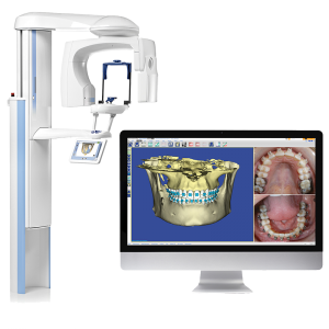 3D ακτινογραφία δοντιών στη Λάρισα | Drakotos-Antonios_CBCT_Promax_3D_imgaging, ΔΡΑΚΩΤΟΣ Γ. ΑΝΤΩΝΙΟΣ - Ακτινοδιαγνώστης – Στρατιωτικός Ιατρός ε.α Ακτινολόγος Λάρισα. ακτινολόγος λαρισα. Ακτινολογικό ιατρείο λάρισα. Aktinologo larisa. Ακτινογραφία Λάρισα. Drakotos-Antonios, aktinografia larisa, aktinologos larisa. Ακτινολόγος λάρισα, οικονομική ακτινογραφία, Ακτινολογικό Εργαστήριο στη Λάρισα, ακτινολογοι στη Λάρισα. Δρακωτός Γ. Αντώνιος. ΜΑΡΙΝΟΥ ΑΝΤΥΠΑ 2 κ ΚΟΥΜΑ, Κεντρική Πλατεία, Λάρισα. Τηλ.(2410) 258 000. Ακτινογραφία με απόλυτη ακρίβεια και μειωμένη έκθεση σε κίνδυνο. Planmeca ProMax 3D. Αξονική τομογραφία οδόντων κωνικής δέσμης CBCT. Έγχρωμα doppler υπερηχογραφήματα οσχέου. Έλεγχος fistula. Αξονική τομογραφία οδόντων κωνικής δέσμης CBCT. Ακτινογραφία ολόκληρης της άνω και κάτω γνάθου με μία μόνο λήψη. Ακτινογραφία Ultra Low Dose με ιδιαίτερα χαμηλή δόση ακτινοβολίας μειωμένη κατά 80% μικρότερη της τυπικής πανοραμικής. Ενδοοδοντολογία με ιδιαίτερα υψηλή ανάλυσηγια. Προσομοίωση τοποθέτησης εμφυτεύματος. Aktinografia larisa, Drakotos-Antonios, Δρακωτός Γ. Αντώνιος. Aktinologos larisa, aktinologos larissa, ακτινολόγος λάρισα, ακτινολόγος λάρισσα, οικονομική ακτινογραφία. Ακτινολογικό Εργαστήριο στη Λάρισα, ακτινολόγοι στη Λάρισα. Γιατροί ακτινολόγοι Λάρισα, ιατροί ακτινολόγοι Λάρισα. Υπερηχογραφήματα Λάρισα, Υπερηχογράφημα Λάρισα, giatros larisa, γιατρός Λάρισα.