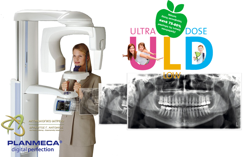 Ψηφιακή Πανοραμική Ακτινογραφία στη Λάρισα - Δρακωτός Γ. Αντώνιος | Αξονική Δοντιών με χαμηλή δόση ακτινοβολίας - Ultra Low Dose CBCT - Δρακωτός Αντώνιος - Ακτινολόγος Λάρισα | Ultra Low Dose CBCT | Αξονική Δοντιών στη Λάρισα με χαμηλή δόση ακτινοβολίας (έως -80%) | 3D ακτινογραφία δοντιών στη Λάρισα | Drakotos-Antonios_CBCT_Promax_3D_imgaging, ΔΡΑΚΩΤΟΣ Γ. ΑΝΤΩΝΙΟΣ - Ακτινοδιαγνώστης – Στρατιωτικός Ιατρός ε.α Ακτινολόγος Λάρισα. ακτινολόγος λαρισα. Ακτινολογικό ιατρείο λάρισα. Aktinologo larisa. Ακτινογραφία Λάρισα. Drakotos-Antonios, aktinografia larisa, aktinologos larisa. Ακτινολόγος λάρισα, οικονομική ακτινογραφία, Ακτινολογικό Εργαστήριο στη Λάρισα, ακτινολογοι στη Λάρισα. Δρακωτός Γ. Αντώνιος. ΜΑΡΙΝΟΥ ΑΝΤΥΠΑ 2 κ ΚΟΥΜΑ, Κεντρική Πλατεία, Λάρισα. Τηλ.(2410) 258 000. Ακτινογραφία με απόλυτη ακρίβεια και μειωμένη έκθεση σε κίνδυνο. Planmeca ProMax 3D. Αξονική τομογραφία οδόντων κωνικής δέσμης CBCT. Έγχρωμα doppler υπερηχογραφήματα οσχέου. Έλεγχος fistula. Αξονική τομογραφία οδόντων κωνικής δέσμης CBCT. Ακτινογραφία ολόκληρης της άνω και κάτω γνάθου με μία μόνο λήψη. Ακτινογραφία Ultra Low Dose με ιδιαίτερα χαμηλή δόση ακτινοβολίας μειωμένη κατά 80% μικρότερη της τυπικής πανοραμικής. Ενδοοδοντολογία με ιδιαίτερα υψηλή ανάλυσηγια. Προσομοίωση τοποθέτησης εμφυτεύματος. Aktinografia larisa, Drakotos-Antonios, Δρακωτός Γ. Αντώνιος. Aktinologos larisa, aktinologos larissa, ακτινολόγος λάρισα, ακτινολόγος λάρισσα, οικονομική ακτινογραφία. Ακτινολογικό Εργαστήριο στη Λάρισα, ακτινολόγοι στη Λάρισα. Γιατροί ακτινολόγοι Λάρισα, ιατροί ακτινολόγοι Λάρισα. Υπερηχογραφήματα Λάρισα, Υπερηχογράφημα Λάρισα, giatros larisa, γιατρός Λάρισα.