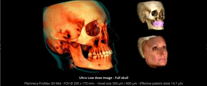 Planmeca Ultra Low Dose 3D imaging(1)