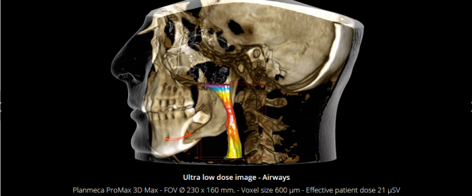 Planmeca Ultra Low Dose 3D imaging(6)