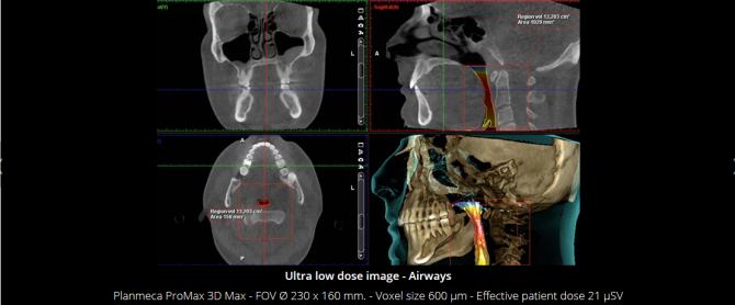 Planmeca Ultra Low Dose 3D imaging(7)